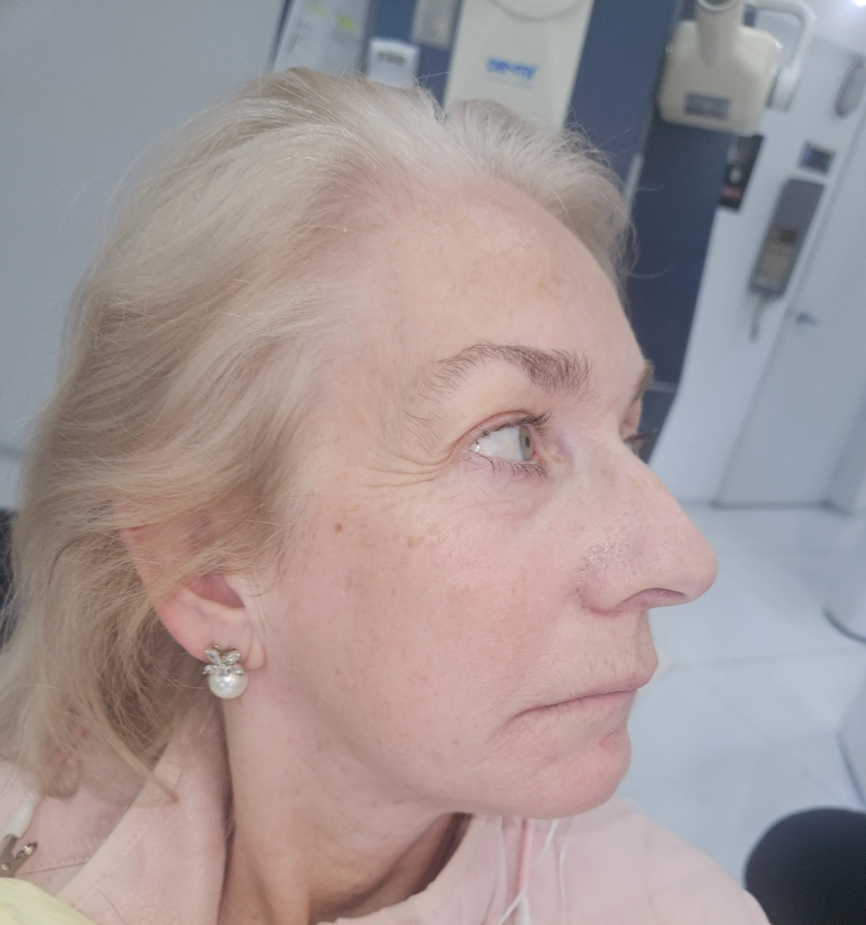 facepreserved